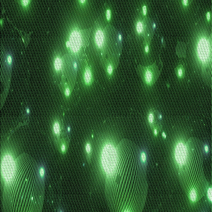 Machine Washable Transitional Dark Forest Green Rug, wshpat15grn