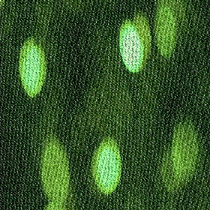 Machine Washable Transitional Dark Forest Green Rug, wshpat150grn