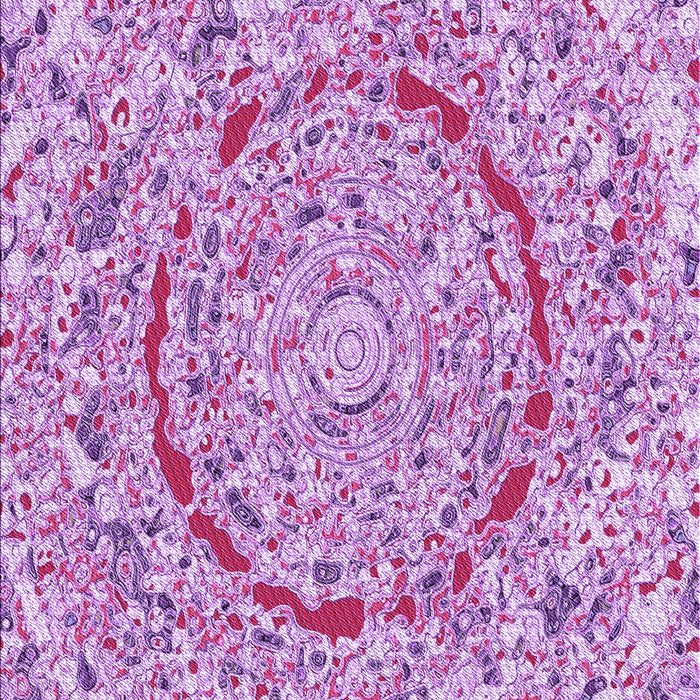 Patterned Blossom Pink Rug, pat3260pur